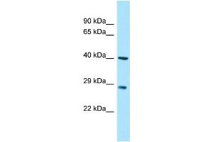 Myozenin 3 Antikörper  (C-Term)