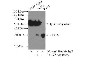 Immunoprecipitation analysis of Jurkat cells lysate 400 μg using UCK2 Antibody at a dilution of 1/1000. (UCK2 Antikörper)