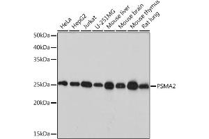 Western blot analysis of extracts of various cell lines, using PSM Rabbit mAb (ABIN7269597) at 1:1000 dilution. (PSMA2 Antikörper)