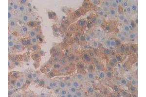 Immunohistochemistry (IHC) image for anti-serpin Peptidase Inhibitor, Clade A (Alpha-1 Antiproteinase, Antitrypsin), Member 6 (SERPINA6) (AA 267-390) antibody (ABIN7438400)