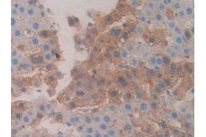 Detection of CBG in Rat Liver Tissue using Polyclonal Antibody to Corticosteroid Binding Globulin (CBG) (SERPINA6 Antikörper  (AA 267-390))