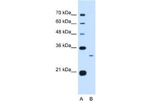 WB Suggested Anti-C1QB Antibody Titration:  0. (C1QB Antikörper  (C-Term))