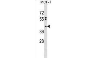 Western Blotting (WB) image for anti-Phosphatidic Acid Phosphatase Type 2 Domain Containing 2 (PPAPDC2) antibody (ABIN2999607) (PPAPDC2 Antikörper)