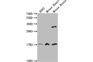 Western Blot Positive WB detected in: K562 whole cell lysate, Mouse heart tissue, Mouse brain tissue All lanes: FUNDC1 antibody at 3 μg/mL Secondary Goat polyclonal to rabbit IgG at 1/50000 dilution Predicted band size: 18 kDa Observed band size: 18 kDa (FUNDC1 Antikörper  (AA 1-46))