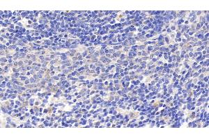 Detection of GRN in Rat Spleen Tissue using Polyclonal Antibody to Granulin (GRN) (Granulin Antikörper  (AA 44-255))