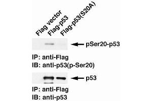 Western Blotting (WB) image for anti-Tumor Protein P53 (TP53) (pSer20) antibody (ABIN3201004) (p53 Antikörper  (pSer20))