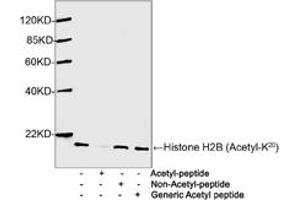 Western blot analysis of Hela cell lysates using 1 µg/mL Antibodies-Online Rabbit Anti-Histone H2B (Acetyl-K20) Polyclonal Antibody (ABIN398911) The signal was developed with IRDyeTM 800 Conjugated Goat Anti-Rabbit IgG. (Histone H2B Antikörper  (Lys20))