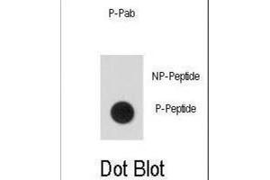 Dot Blot (DB) image for anti-Signal Transducer and Activator of Transcription 5A (STAT5A) (pSer726) antibody (ABIN5021402) (STAT5A Antikörper  (pSer726))
