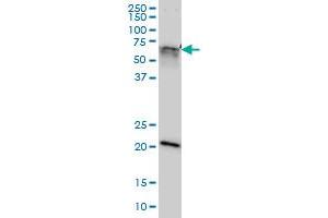 GATAD2A monoclonal antibody (M01), clone 3F3 Western Blot analysis of GATAD2A expression in Hela NE