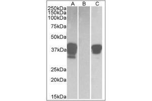 HEK293 lysate (10 µg protein in RIPA buffer) overexpressing Human POU2AF1 with DYKDDDDK tag probed with POU2AF1 Antibody  (1 µg/ml) in Lane A and probed with anti-DYKDDDDK Tag (1/3000) in Lane C. (POU2AF1 Antikörper  (C-Term))
