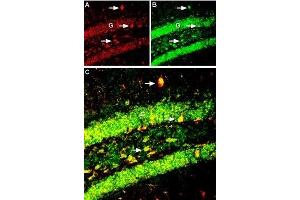 Multiplex staining of Kir6.