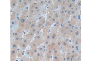 Used in DAB staining on fromalin fixed paraffin- embedded liver tissue (HARS1/Jo-1 Antikörper  (AA 1-294))