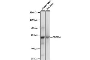 Western blot analysis of extracts of various cell lines, using ZNF124 antibody (ABIN7271452) at 1:1000 dilution. (ZNF124 Antikörper  (AA 60-200))