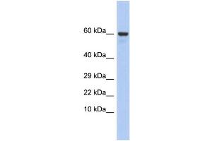 Western Blotting (WB) image for anti-Taxilin gamma (TXLNG) (N-Term) antibody (ABIN2785688)