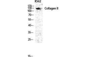 Western Blot (WB) analysis of specific cells using COL2A1 Polyclonal Antibody.