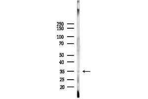Rabbit anti-Human IgA (C-Term) antibody