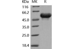 Western Blotting (WB) image for Arylsulfatase A (ARSA) (Active) protein (His tag) (ABIN7320436)