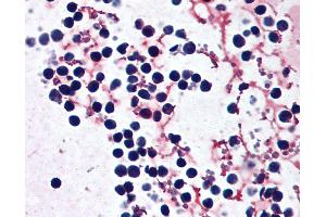 Anti-NLRP3 antibody IHC of human peripheral blood leukocytes. (NLRP3 Antikörper  (AA 82-93))