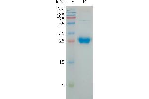 Human CXADR Protein, His Tag on SDS-PAGE under reducing condition.