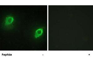 Immunofluorescence analysis of HeLa cells, using AKAP5 polyclonal antibody . (AKAP5 Antikörper  (N-Term))