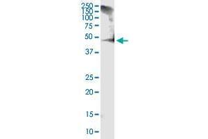 RCN1 monoclonal antibody (M01), clone 1F8-E4. (RCN1 Antikörper  (AA 31-331))