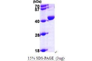SDS-PAGE (SDS) image for Uroporphyrinogen Decarboxylase (UROD) (AA 1-367) protein (His tag) (ABIN667032)