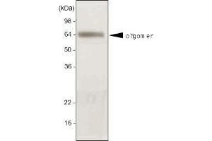 Western blot analysis. (ADIPOQ Antikörper  (AA 15-244))