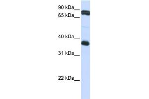 WB Suggested Anti-GP6 Antibody Titration:  0.