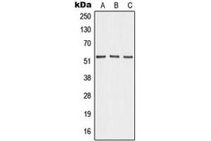 Western blot analysis of Angiopoietin-4 expression in HEK293T (A), mouse lung (B), PC12 (C) whole cell lysates.