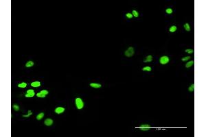 Immunofluorescence of purified MaxPab antibody to RECQL on HeLa cell. (RecQ Protein-Like (DNA Helicase Q1-Like) (RECQL) (AA 1-649) Antikörper)