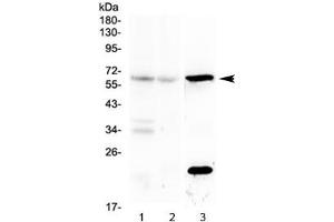 Western blot testing of mouse 1) brain, 2) liver and 3) kidney lysate with Il23r antibody at 0.