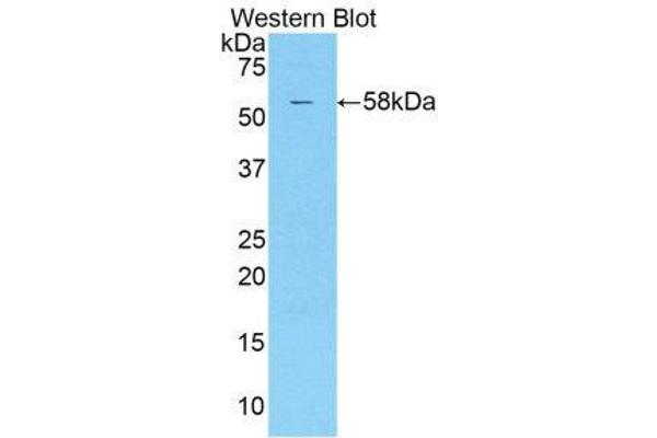 KIR2DS2 抗体  (AA 22-304)