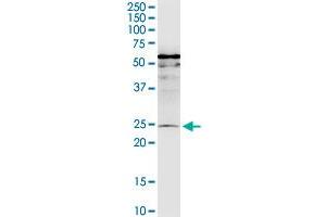 MIS12 monoclonal antibody (M01), clone 1G3. (MIS12 Antikörper  (AA 1-205))