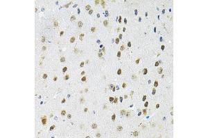 Immunohistochemistry of paraffin-embedded mouse brain using PPP1CA antibody. (PPP1CA Antikörper)