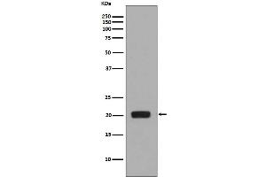 Western blot analysis of MCSF expression in MCSF recombinant protein.
