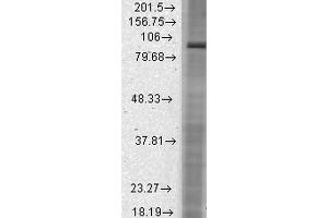 Western Blot analysis of Rat brain membrane lysate showing detection of HCN2 protein using Mouse Anti-HCN2 Monoclonal Antibody, Clone S71-37 .