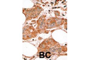 Immunohistochemistry (IHC) image for anti-BCL2-Like 14 (Apoptosis Facilitator) (BCL2L14) (BH3 Domain) antibody (ABIN2997105) (BCL2L14 Antikörper  (BH3 Domain))