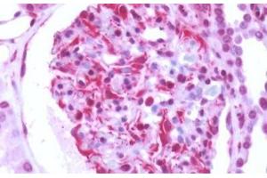 Immunohistochemistry (IHC) image for anti-G Protein-Coupled Receptor, Family C, Group 5, Member B (GPRC5B) (N-Term) antibody (ABIN1048911)