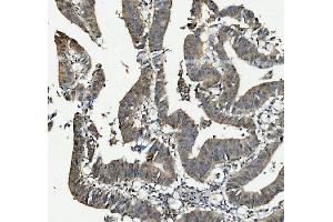 IHC analysis of ANAPC2 using anti-ANAPC2 antibody (ABIN7601930). (ANAPC2 Antikörper  (AA 51-272))