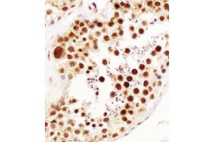 Antibody staining ELAVL1 in human testis tissue sections by Immunohistochemistry (IHC-P - paraformaldehyde-fixed, paraffin-embedded sections). (ELAVL1 Antikörper)