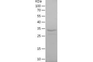 SLC22A6 Protein (AA 460-563) (His-IF2DI Tag)