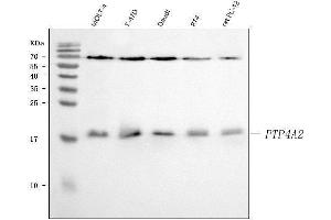 Western blot analysis of PTP4A2 using anti-PTP4A2 antibody (ABIN3043911).