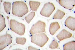 Image no. 1 for anti-CASP8 and FADD-Like Apoptosis Regulator (CFLAR) antibody (ABIN272307) (FLIP Antikörper)