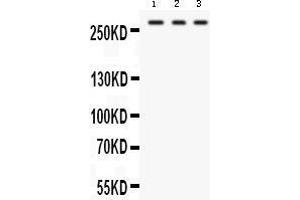 Western blot analysis of FASN expression in HEPG2 whole cell lysates (lane 1), U87 whole cell lysates (lane 2) and RAJI whole cell lysates (lane 3).