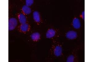 IF analysis of SNX6 using anti-SNX6 antibody (ABIN7599362). (SNX6 Antikörper  (AA 1-406))