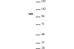 GLI1 antibody (pAb) tested by Western blot. (GLI1 Antikörper  (C-Term))