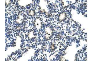 PCBP2 antibody was used for immunohistochemistry at a concentration of 4-8 ug/ml to stain Alveolar cells (arrows) in Human Lung.