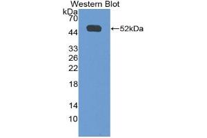 Western blot analysis of the recombinant protein. (IFNGR1 Antikörper  (AA 23-253))