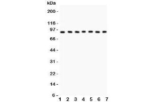 Western blot testing of MSK1 antibody and Lane 1:  human placenta;  2: rat brain;  3: (h) Jurkat;  4: (h) HeLa;  5: (h) PANC;  6: (h) A549;  7: (h) HEPG2. (MSK1 Antikörper  (AA 540-665))