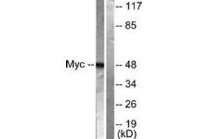 Western blot analysis of extracts from HeLa cells, treated with Forskolin 40nM 30', using MYC (Ab-62) Antibody. (c-MYC Antikörper  (AA 31-80))